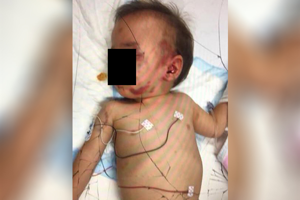 Article image for EXCLUSIVE | Horrific image shows toddler covered in scars