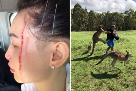 Tourists warned after a series of kangaroo attacks