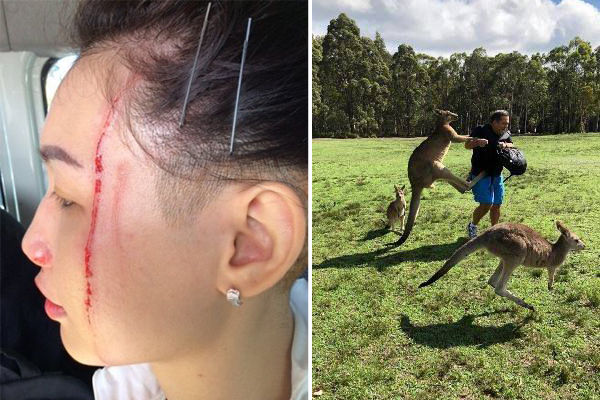 Article image for Tourists warned after a series of kangaroo attacks