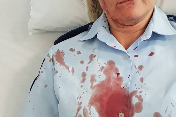 Horror injuries: Female police officer bashed while helping alleged criminal