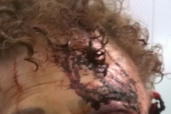 GRAPHIC WARNING | Grandmother’s horrific injuries after being bashed by teenager