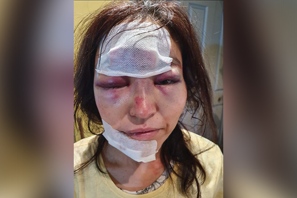 Article image for Police confident public will ‘dob in’ men who bashed Sydney woman
