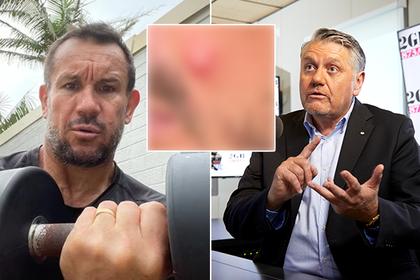 Ray Hadley’s urgent recommendation for Matty Johns’ ‘infected talent’