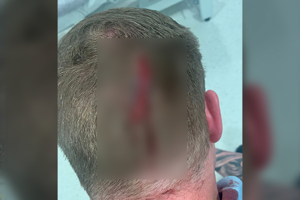 Article image for GRAPHIC | Police officer sustains brutal head wound in domestic violence siege
