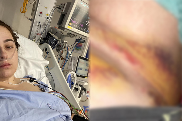 Article image for NSW car crash victim ‘beyond mortified’ by cross-border hospital fiasco