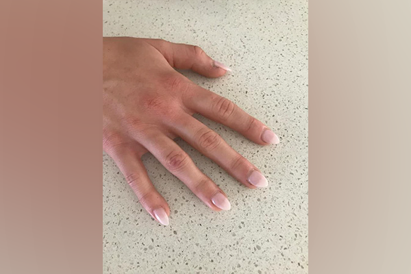Article image for Girls denied graduation at Manly school over length of nails