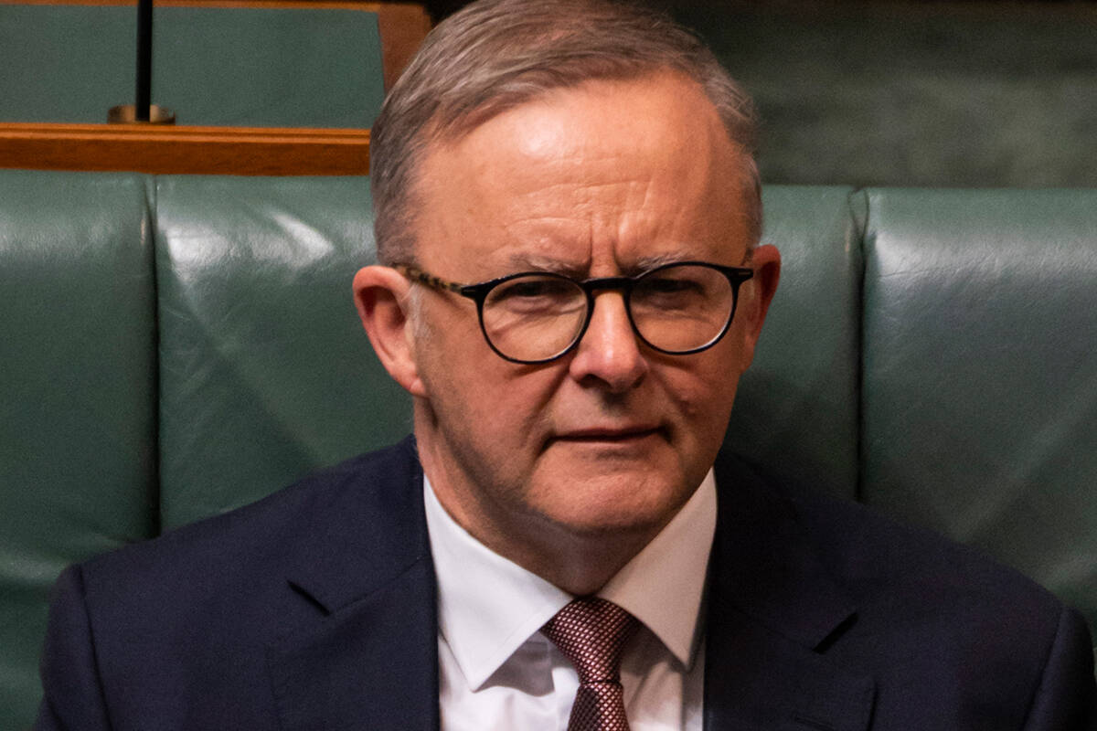 Anthony Albanese