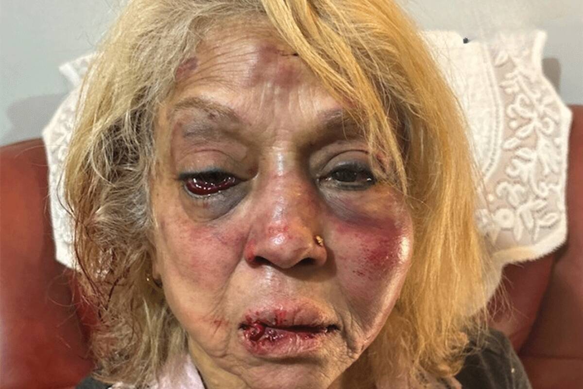 Article image for ‘Bashed + bruised’ – Grandma becomes face of Labor’s failure