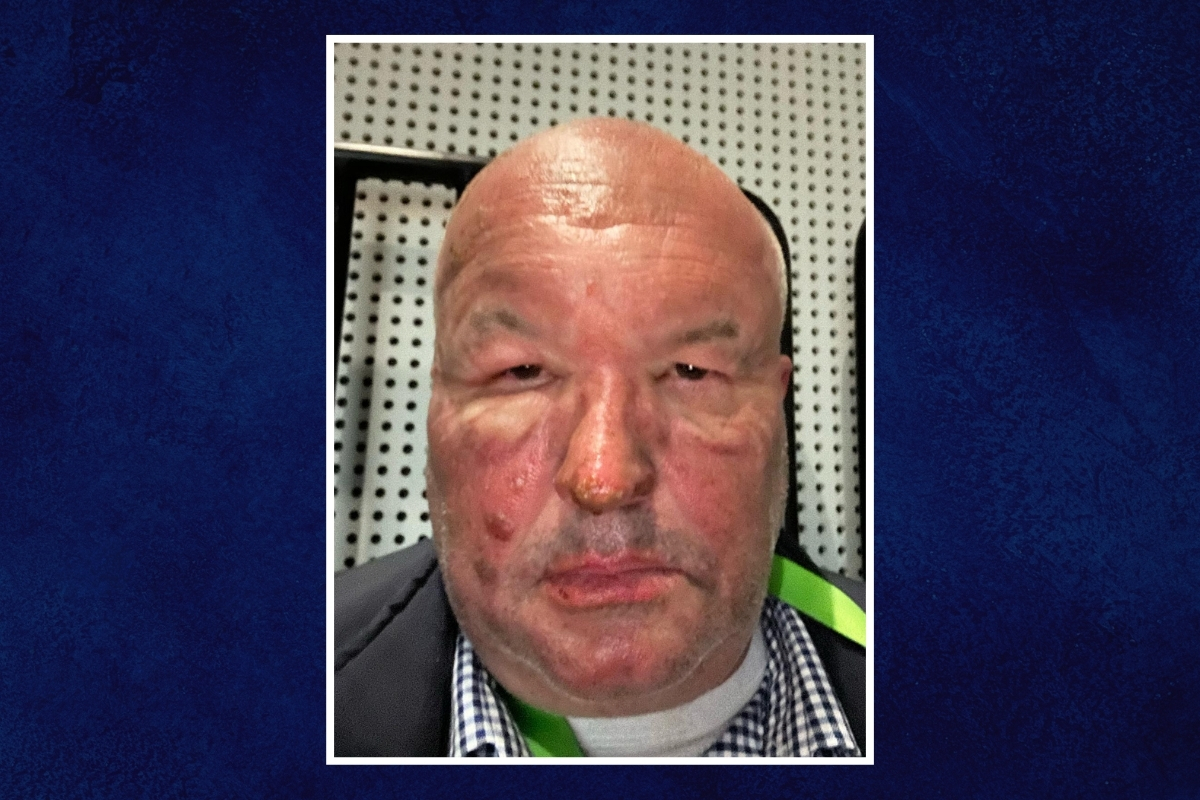 Article image for Exclusive – Former Minister burned in vicious BBQ explosion