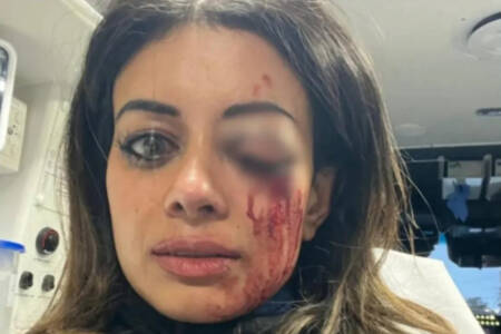 ‘Protestor v Police’ – Former Greens candidate at risk of losing eyesight