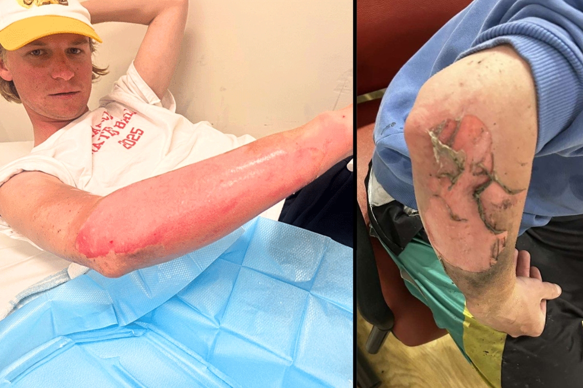 Article image for EXCLUSIVE – Student hospitalised after phone charger explosion