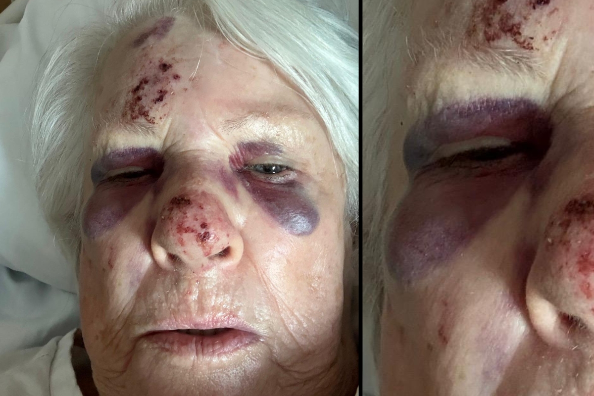 Article image for EXCLUSIVE – Elderly woman suffers brain bleed after being hit by E-bike