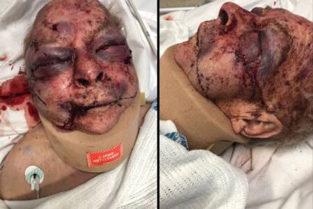 EXCLUSIVE – 87-year-old bashed in nursing home