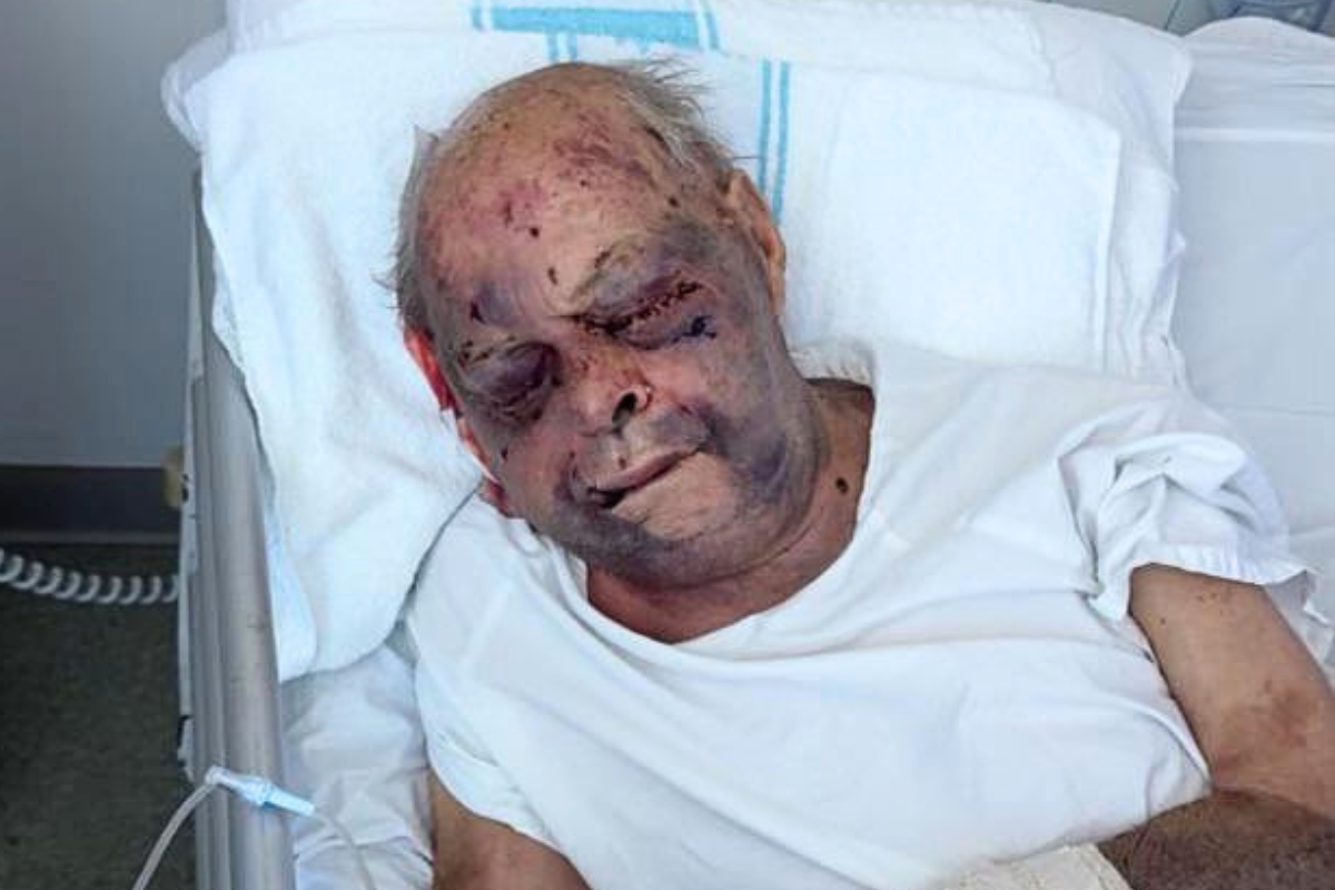 Article image for EXCLUSIVE – 87-year-old bashed in nursing home suffers brain bleed